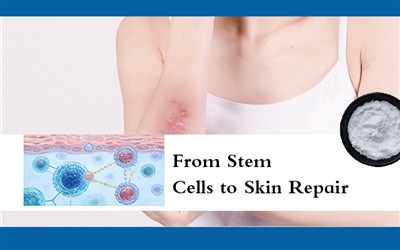 Soti nan Selil Stem Pou Reparasyon Po