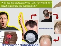 Poukisa DHT vin yon sib kle nan rechèch pwostat ak cheve